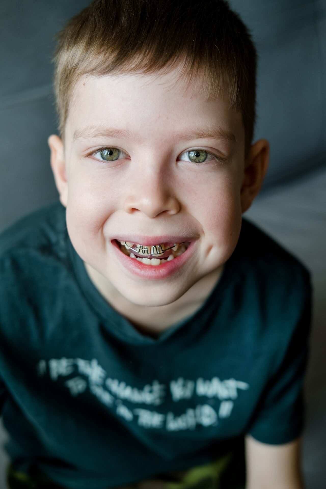 close-up-portrait-of-a-boy-in-braces-correction-o-2023-11-27-05-31-51-utc