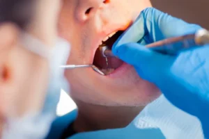 Implantes dentales precio Lima